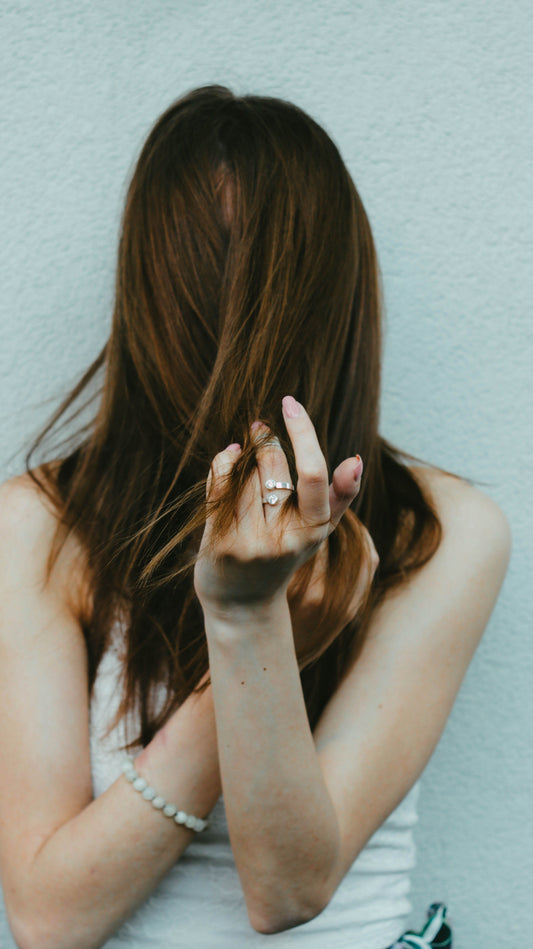 The Dandruff Dilemma
